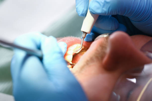 Best Emergency Treatment for Oral Infections in Pasadena Hills, FL