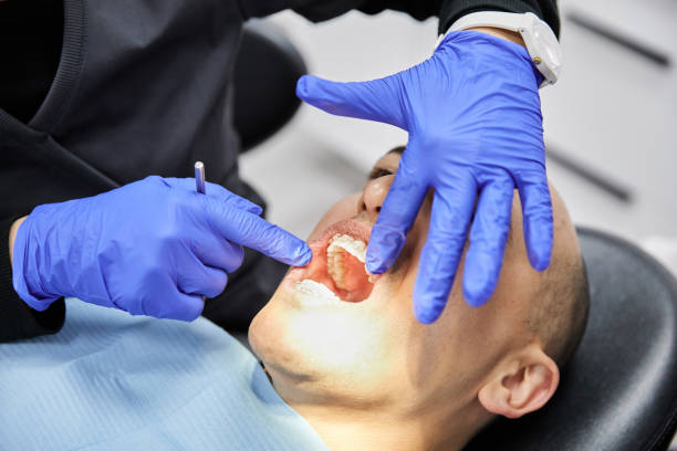 Best Emergency Dental Care for Sports Injuries in Pasadena Hills, FL
